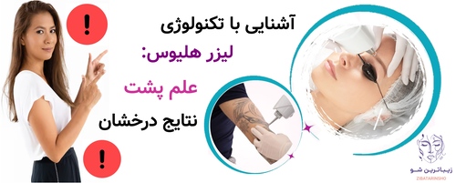 آشنایی با تکنولوژی لیزر هلیوس: علم پشت نتایج درخشان