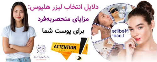 دلایل انتخاب لیزر هلیوس: مزایای منحصربهفرد برای پوست شما