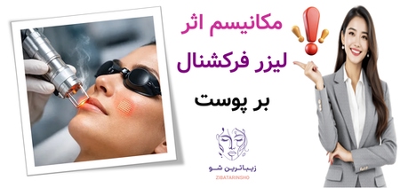 مکانیسم اثر لیزر فرکشنال بر پوست