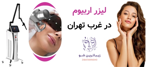 لیزر اربیوم در غرب تهران
