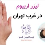 لیزر اربیوم در غرب تهران