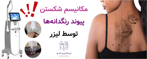 مکانیسم شکستن پیوند رنگدانهها توسط لیزر