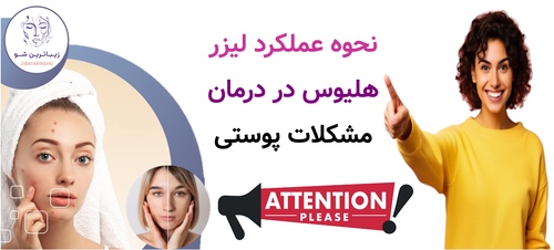 نحوه عملکرد لیزر هلیوس در درمان مشکلات پوستی