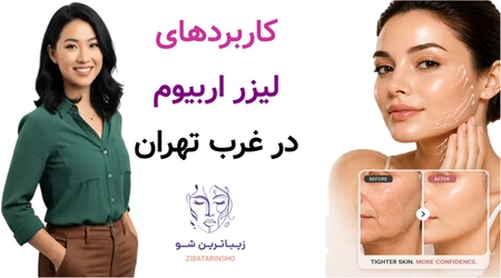 کاربردهای لیزر اربیوم در غرب تهران