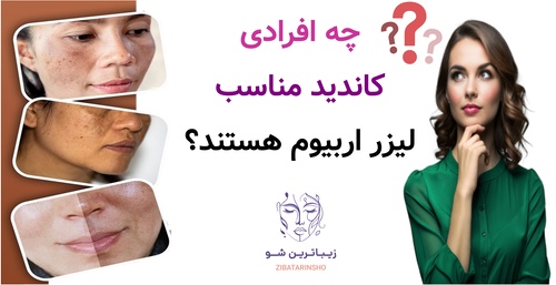 چه کسانی کاندید مناسب لیزر اربیوم هستند؟