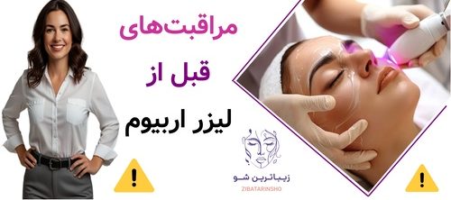 مراقبتهای قبل از لیزر اربیوم