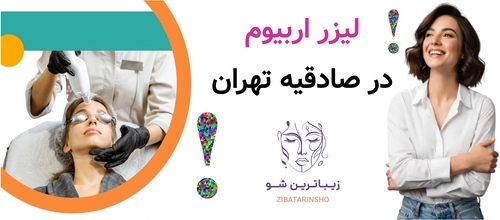 لیزر اربیوم در صادقیه تهران