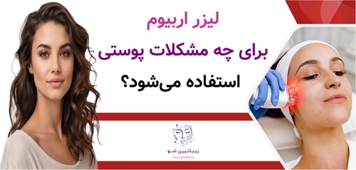لیزر اربیوم برای چه مشکلات پوستی استفاده میشود؟
