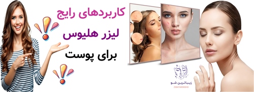 کاربردهای رایج لیزر هلیوس برای پوست