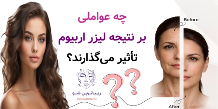 چه عواملی بر نتیجه لیزر اربیوم تأثیر میگذارند؟