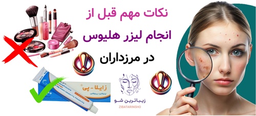نکات مهم قبل از انجام لیزر هلیوس در مرزداران