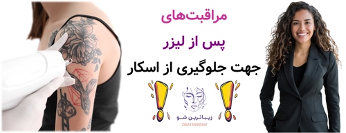 مراقبتهای پس از لیزر جهت جلوگیری از اسکار