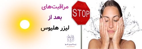مراقبتهای بعد از لیزر هلیوس