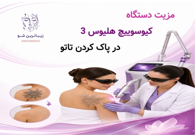 مزیت دستگاه کیوسوییچ هلیوس 3 در پاک کردن تاتو