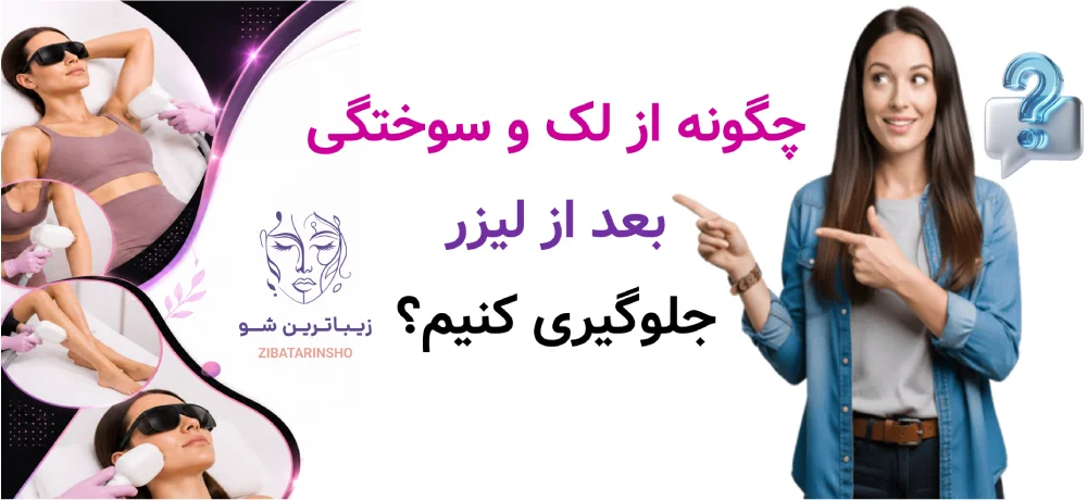 چگونه از لک و سوختگی بعد از لیزر جلوگیری کنیم؟