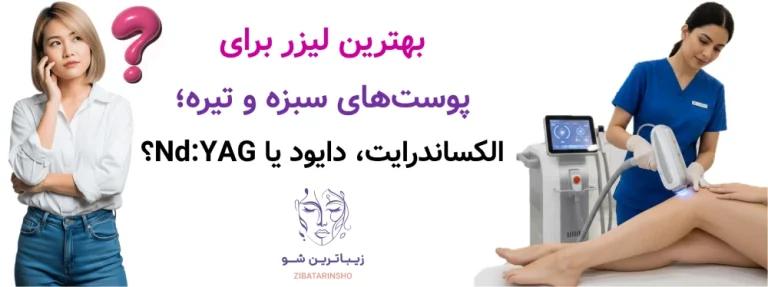 بهترین لیزر برای پوست‌های سبزه و تیره؛ الکساندرایت، دایود یا Nd:YAG؟