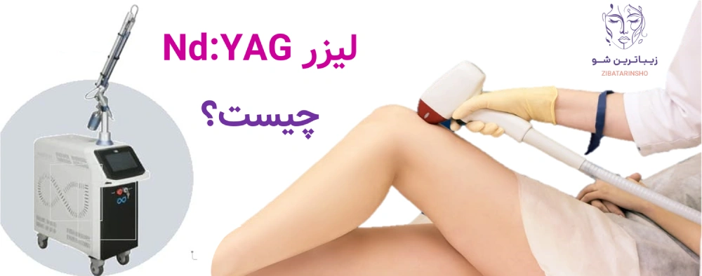 لیزر Nd:YAG چیست؟
