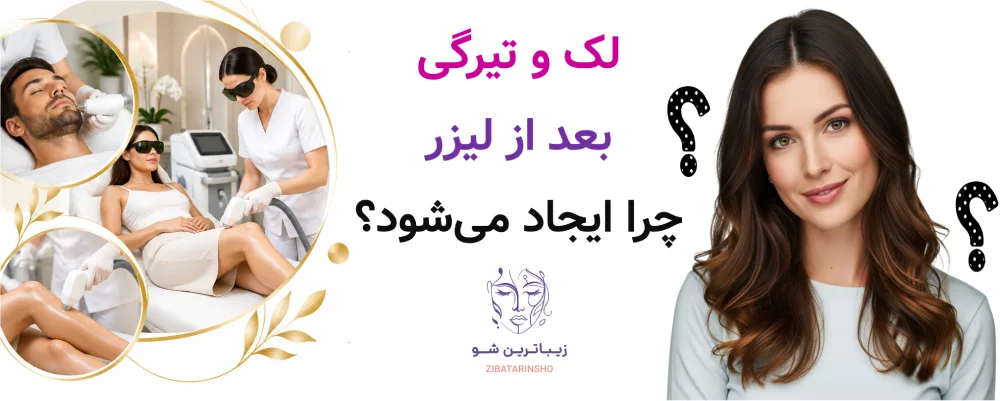 لک و تیرگی بعد از لیزر چرا ایجاد میشود؟