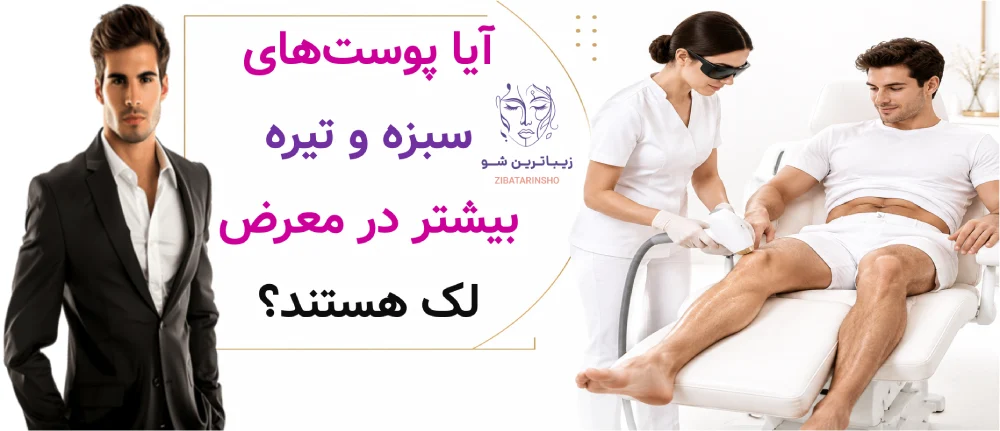 آیا پوستهای سبزه و تیره بیشتر در معرض لک هستند؟