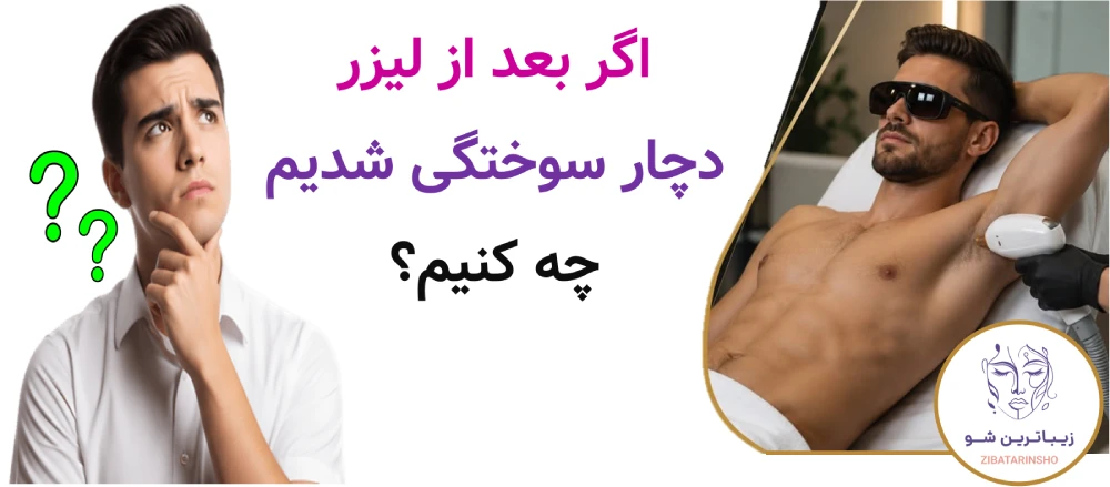 اگر بعد از لیزر دچار سوختگی شدیم چه کنیم؟