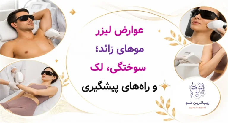 عوارض لیزر موهای زائد؛ سوختگی، لک و راه‌های پیشگیری