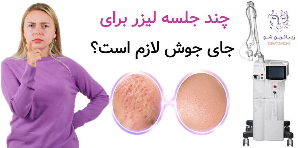 لیزر co2 فرکشنال یا اربیوم؛ کدام برای جای جوش و اسکار بهتر است؟