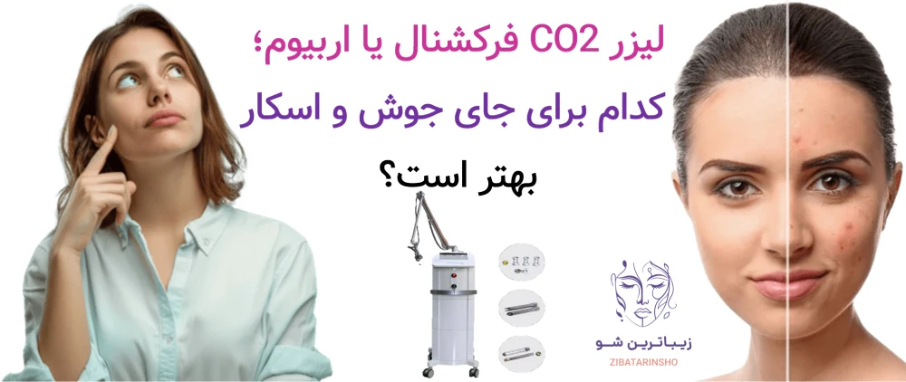 لیزر co2 فرکشنال یا اربیوم؛ کدام برای جای جوش و اسکار بهتر است؟