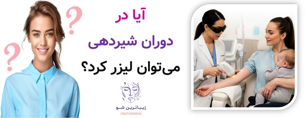 آیا در دوران شیردهی میتوان لیزر کرد؟